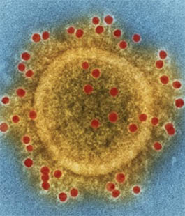 "Coronavirus Design Competition" di DesignClass: concorso di idee per rispondere alla pandemia